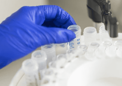 Protein Purification
